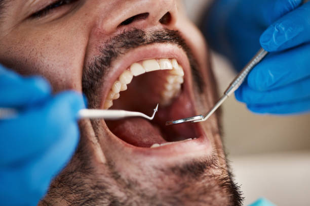 Best Cracked Tooth Emergency Dentist  in Gladeview, FL